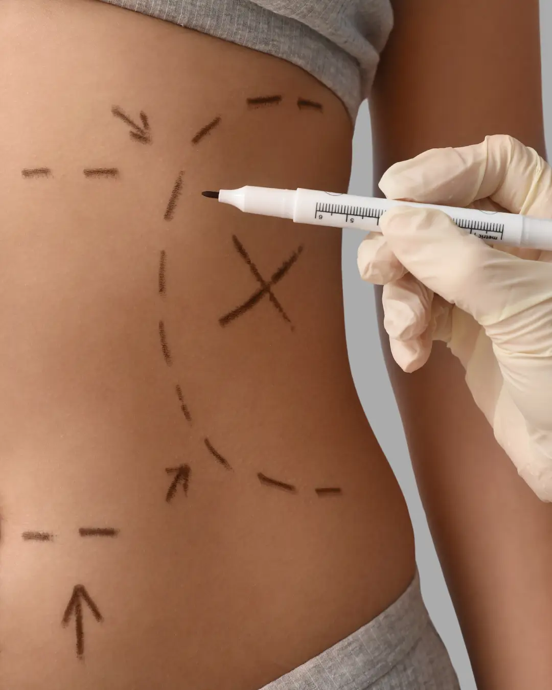 Plastic Surgery Marketing